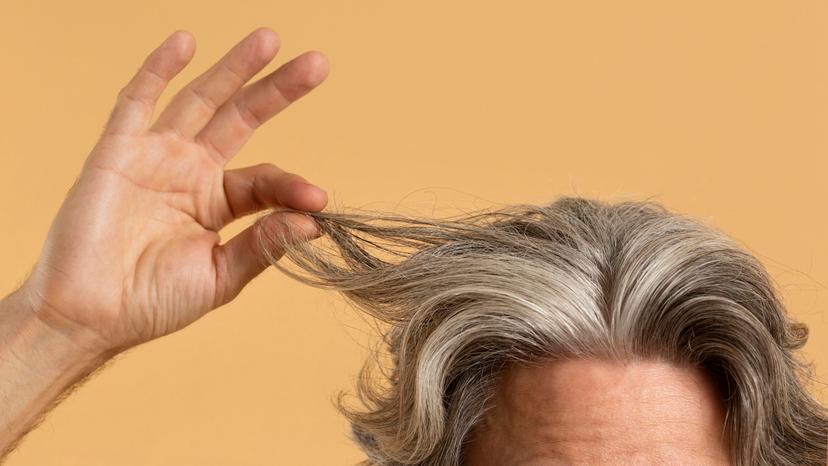 Stres Bikin Rambut Beruban, Benarkah? 