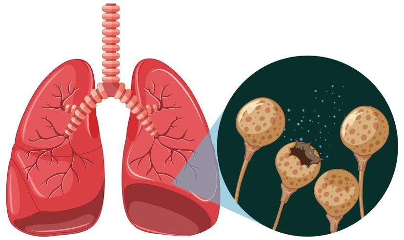 Program Cek Kesehatan Gratis, Dokter Paru Beri Saran Gunakan AI