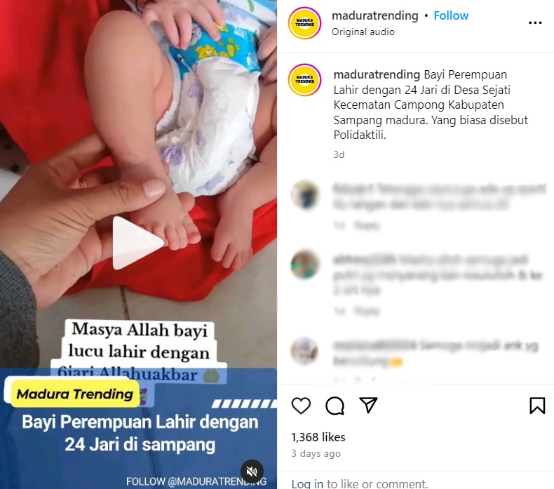 Bayi yang lahir dengan 24 jari. (Tangkap layar akun IG @maduratrending)